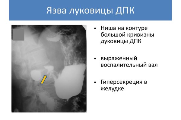 Кракен как войти через тор